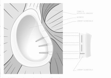 Druck Labrum 2